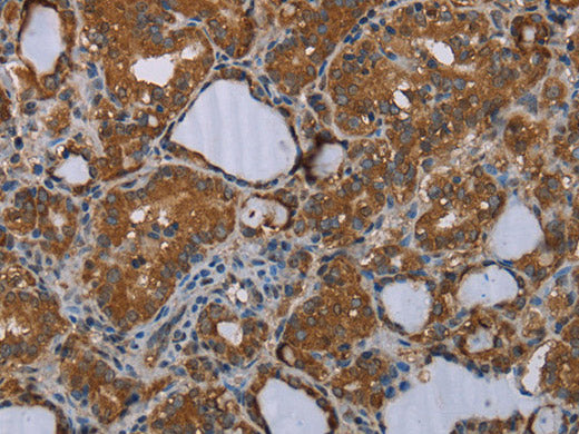MEIS1 Polyclonal Antibody Store at -20°C