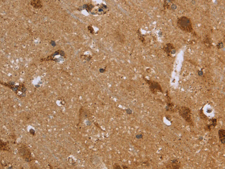 FH Polyclonal Antibody Store at -20°C