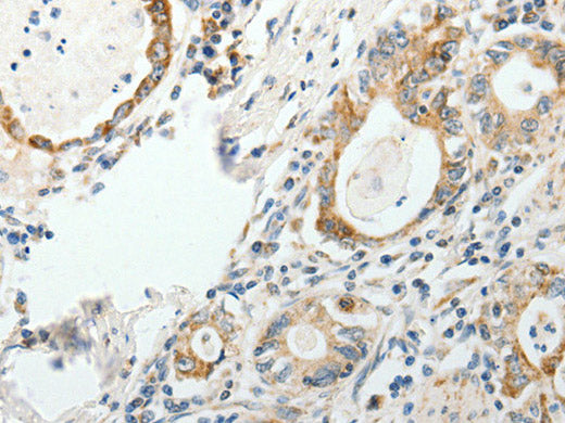 GEMIN2 Polyclonal Antibody Store at -20°C
