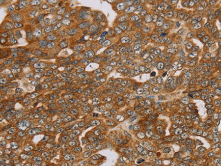 PLEKHG6 Polyclonal Antibody Store at -20°C