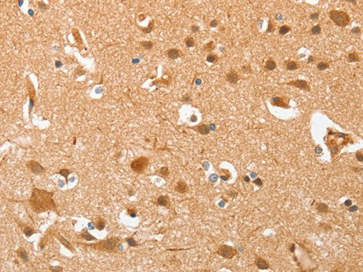 AHSG Polyclonal Antibody Store at -20°C