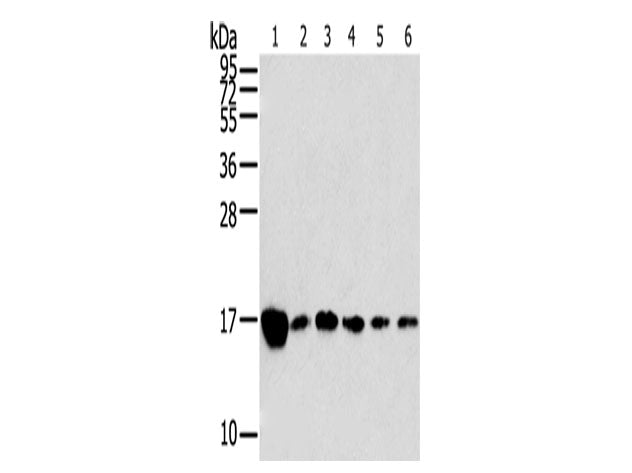 RPLP2 Polyclonal Antibody Store at -20°C