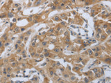 PD-1/CD279 Polyclonal Antibody Store at -20°C