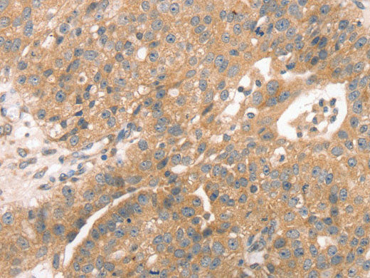 STX10 Polyclonal Antibody Store at -20°C