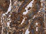 CERS5 Polyclonal Antibody Store at -20°C