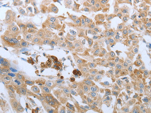 FGF1 Polyclonal Antibody Store at -20°C