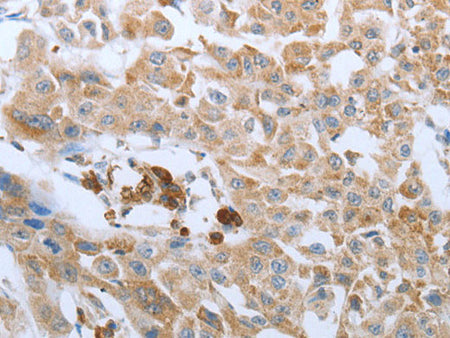 FGF1 Polyclonal Antibody Store at -20°C