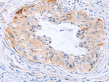 CARD6 Polyclonal Antibody Store at -20°C