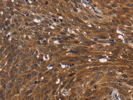 FHIT Polyclonal Antibody Store at -20°C