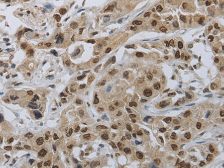 PRKAR1B Polyclonal Antibody Store at -20°C