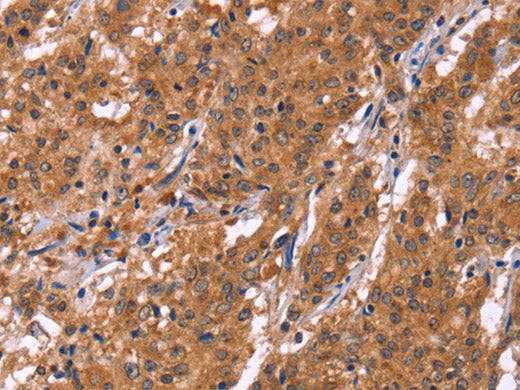 HLTF Polyclonal Antibody Store at -20°C