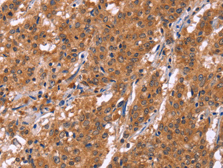 HLTF Polyclonal Antibody Store at -20°C