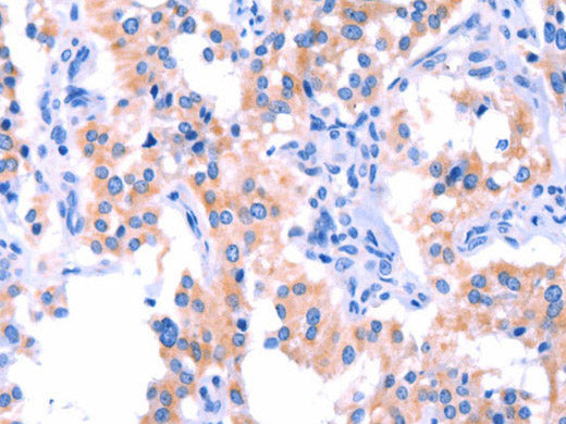 ERN2 Polyclonal Antibody Store at -20°C