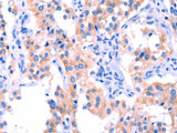 ERN2 Polyclonal Antibody Store at -20°C