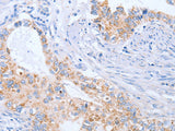 BST1 Polyclonal Antibody Store at -20°C
