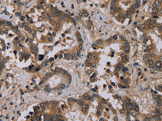 CD242 Polyclonal Antibody Store at -20°C
