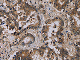 CD242 Polyclonal Antibody Store at -20°C