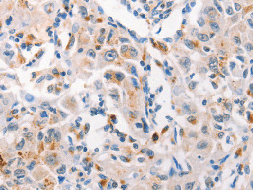 MUC2 Polyclonal Antibody Store at -20°C