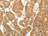 MAP1B Polyclonal Antibody Store at -20°C