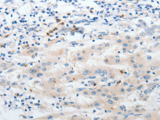LCN2 Polyclonal Antibody Store at -20°C