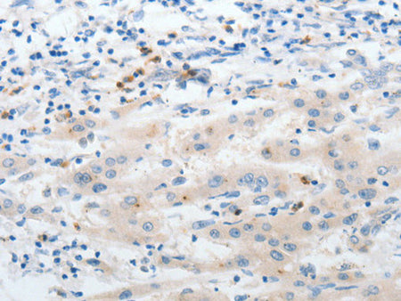 LCN2 Polyclonal Antibody Store at -20°C