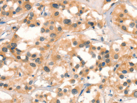 CUEDC2 Polyclonal Antibody Store at -20°C
