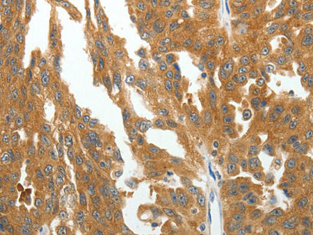 RGS2 Polyclonal Antibody Store at -20°C