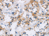 IAPP Polyclonal Antibody