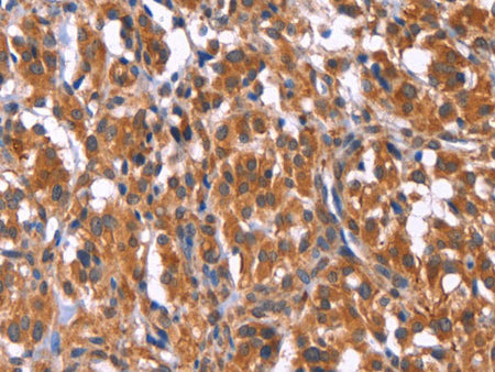 TDP2 Polyclonal Antibody Store at -20°C
