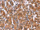 TDP2 Polyclonal Antibody Store at -20°C