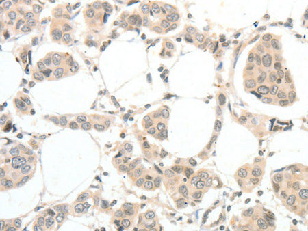 TSPYL2 Polyclonal Antibody Store at -20°C