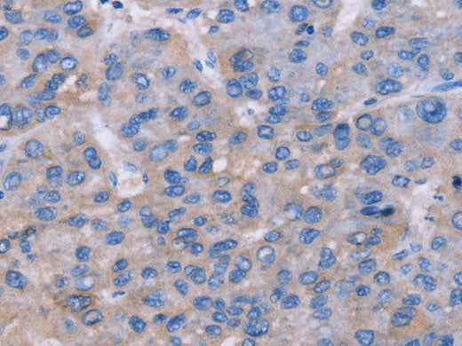 NR1D1 Polyclonal Antibody
