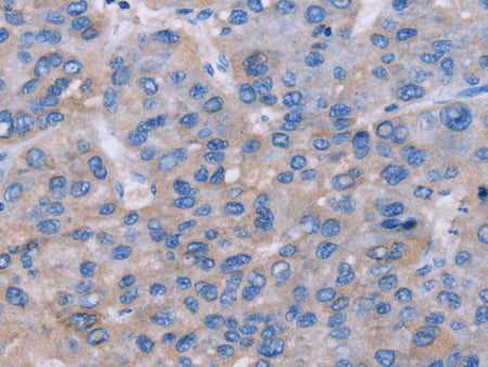 NR1D1 Polyclonal Antibody