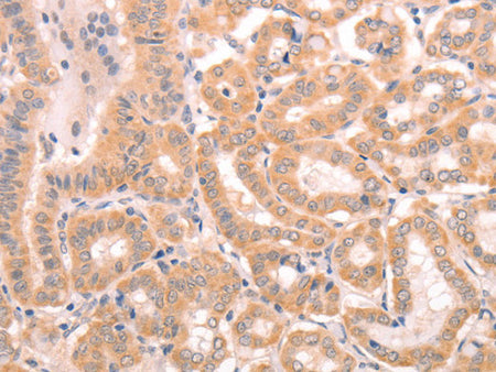 TRPC3 Polyclonal Antibody Store at -20°C