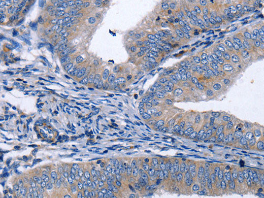 BDNF Polyclonal Antibody Store at -20°C