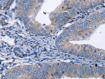 BDNF Polyclonal Antibody Store at -20°C