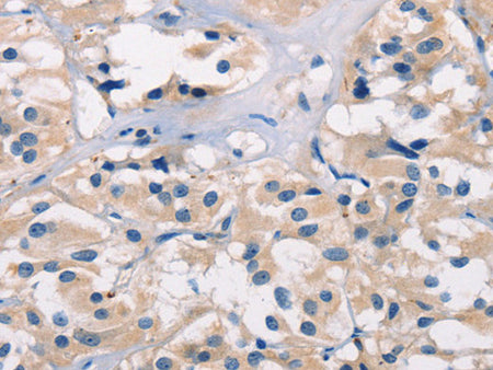 ADGRB1 Polyclonal Antibody Store at -20°C