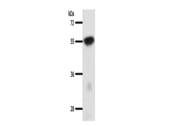 SLC32A1 Polyclonal Antibody Store at -20°C