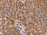 ESRRB Polyclonal Antibody Store at -20°C
