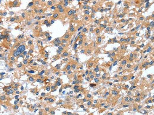 DSC1 Polyclonal Antibody Store at -20°C