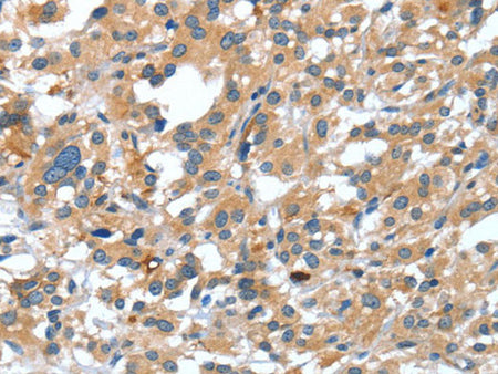 DSC1 Polyclonal Antibody Store at -20°C