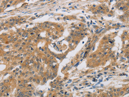 CST6 Polyclonal Antibody Store at -20°C