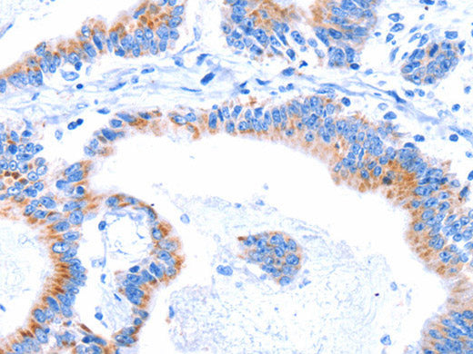 SMG8 Polyclonal Antibody
