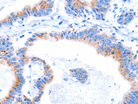 SMG8 Polyclonal Antibody