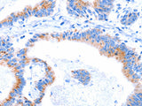 SMG8 Polyclonal Antibody