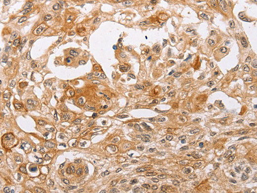 PPP1CB Polyclonal Antibody Store at -20°C
