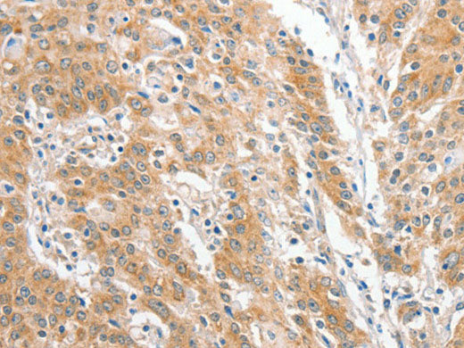 COL4A3BP Polyclonal Antibody Store at -20°C