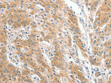 COL4A3BP Polyclonal Antibody Store at -20°C