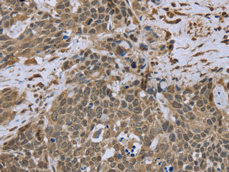 DCTN4 Polyclonal Antibody Store at -20°C