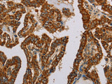 NDUFS5 Polyclonal Antibody